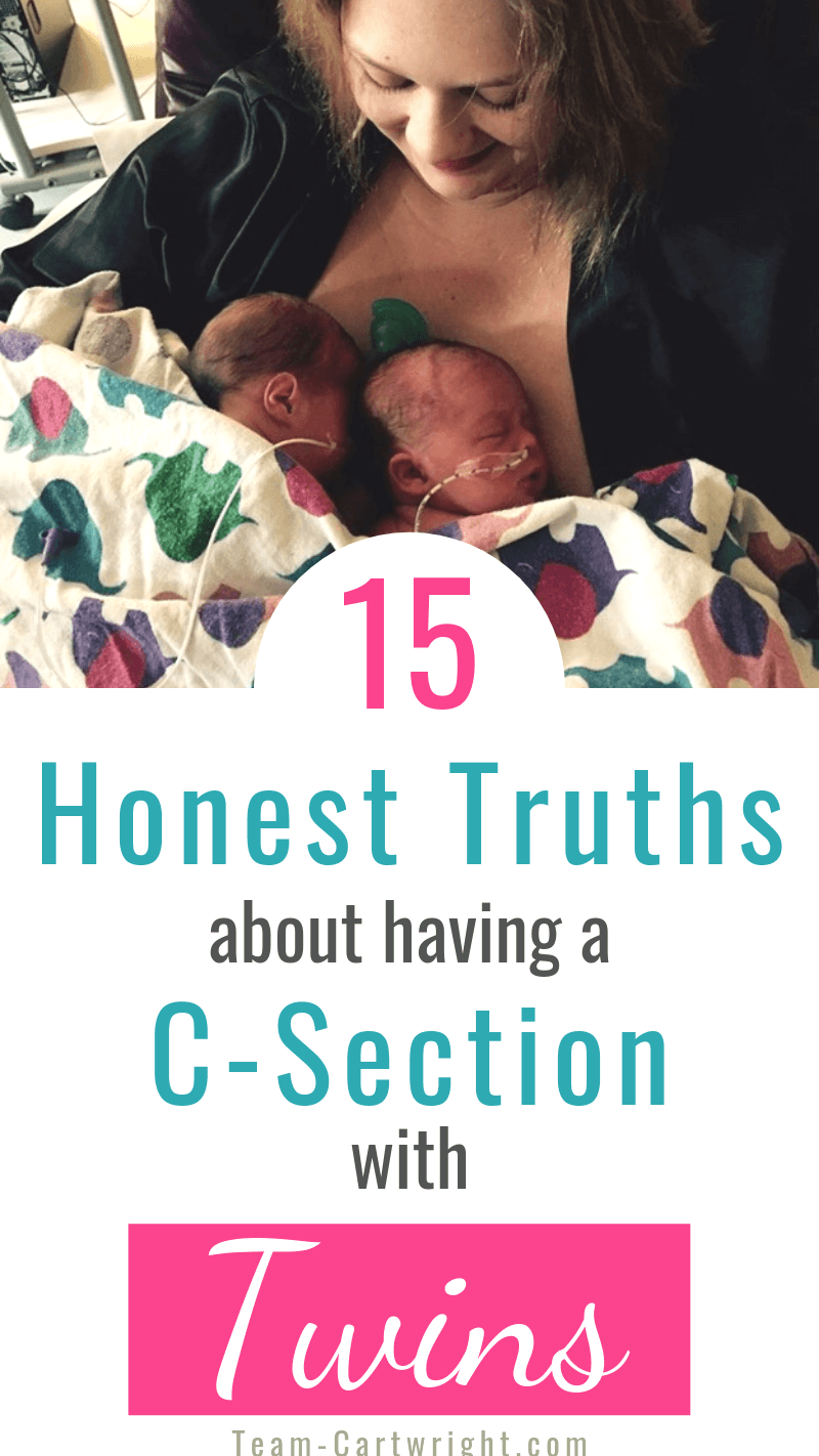 15 Truths About CSections with Twins (And Twin CSection FAQ and A)